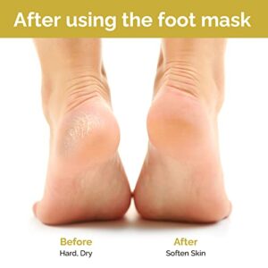 Foot Mask - 5 Pairs Lavender & Honey Foot Spa for Rough Dry Cracked Feet Reduce Dead Skin, Moisturizing Socks for Baby Foot, Relaxing Soft Feet Treatment for Women & Men, Foot Care Christmas Gifts