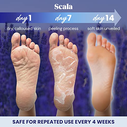 Scala Foot Peel Mask Treatment (2 Pack) Dead Skin Remover For Feet, Dry Cracked Feet, Exfoliator Gel Fixes Cracked Heels, Peeling Reveals Baby Soft Smooth Skin, Lavender - Birthday Gifts for Women