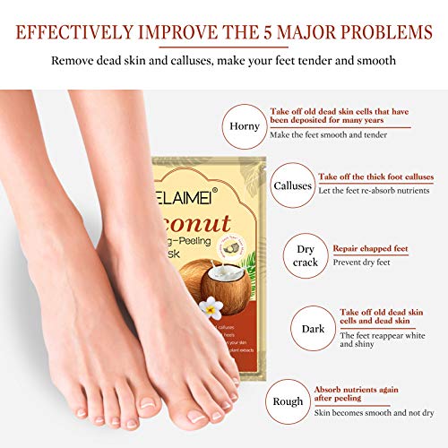 Foot Peel Mask 3 Pack-Feet Peeling Mask,Exfoliating Peeling Foot Mask,Foot Peel Exfoliator Remove,Peel Off Calluses & Dead Skin,Make Your Feet Baby Soft,Exfoliating Peeling Natural Treatment