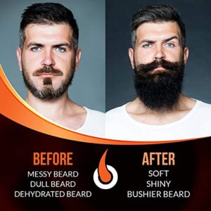 Beard Growth Oil - 1Fl Oz - Growing Serum That Softens & Strengthens Beards and Mustaches - Facial Hair Treatment Treatment Infused with Biotin Capilia Longa Niacinamide and 100% Natural Ingredients