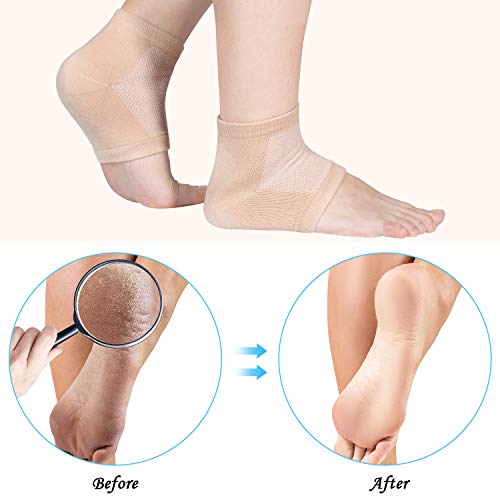 Bememo 4 Pairs of Moisturizing Soft Gel Heel Socks Breathable Open Toe Socks for Dry Cracked Skin Hydrating Day and Night Care Skin