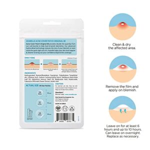 Avarelle Pimple Patches (40 Count) Hydrocolloid Acne Cover Patches | Zit Patches for Blemishes, Zits and Breakouts with Tea Tree, Calendula and Cica Oil for Face | Vegan, Cruelty Free Certified, Carbonfree Certified (40 PATCHES) (MEDIUM, 80)