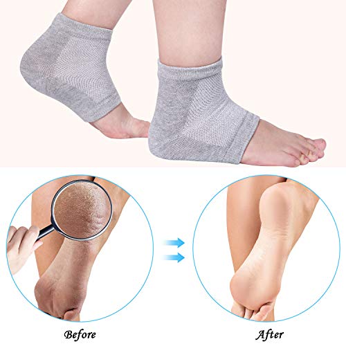 Bememo Soft Gel Heel Socks Ventilate Open Toe Socks 4 Pairs for Dry Hard Cracked Skin Moisturizing Day Night Care Skin (Gray)