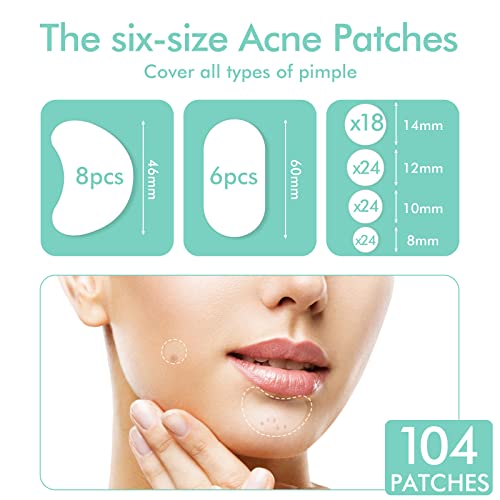 Mandabloom Acne Pimple Patches, 6 Sizes 104 Patches for Large Zit Breakouts, Acne Patches for Face, Chin or Body, Hydrocolloid Bandages Acne Treatment with Tea Tree & Calendula Oil & Salicylic Acid