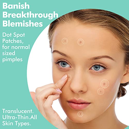 Mandabloom Acne Pimple Patches, 6 Sizes 104 Patches for Large Zit Breakouts, Acne Patches for Face, Chin or Body, Hydrocolloid Bandages Acne Treatment with Tea Tree & Calendula Oil & Salicylic Acid