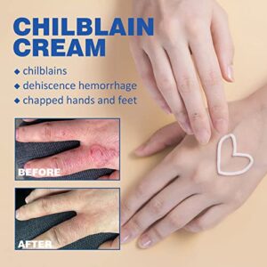 LONGLUAN Chilblain Cream, Anti-cracking Frostbite Moisturiser, Anti Crack Cream for Hands and Foot, Cracked Skin Repair Cream, Chapped Repair Cream, Deep Nourishing 30g (1)