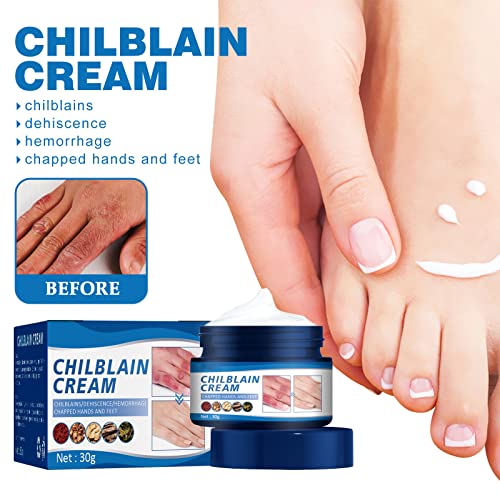 LONGLUAN Chilblain Cream, Anti-cracking Frostbite Moisturiser, Anti Crack Cream for Hands and Foot, Cracked Skin Repair Cream, Chapped Repair Cream, Deep Nourishing 30g (1)