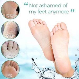 I PEEL GOOD! This 4-pair foot mask provides an at-home pampering spa experience to intensely moisturize, repair and soften rough and dry feet. The foot mask penetrates deeply to heal and hydrate dry cracked skin, restoring your skin's natural moisture bal
