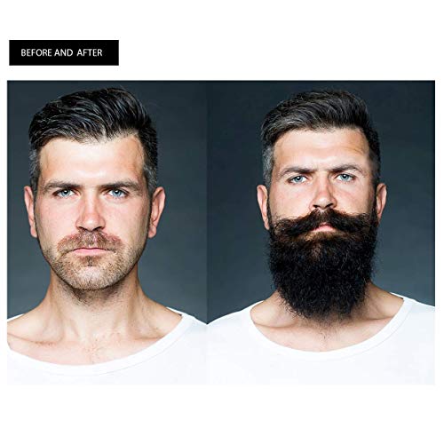 YOUCOPIA Beard Growth Kit (2in1)