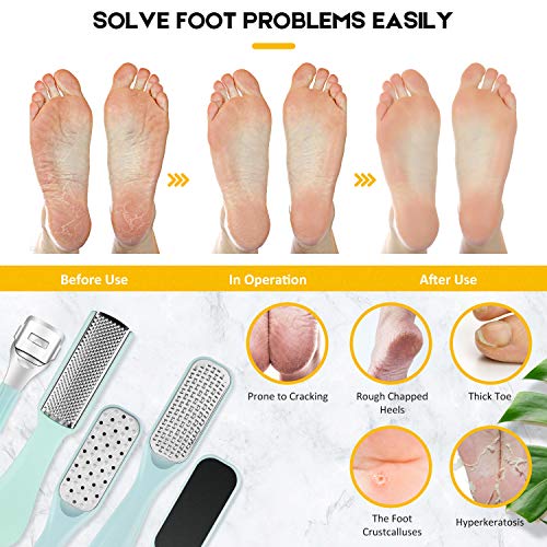 Pedicure Foot File Tools Kit - Professional Feet Corns Callus Remover Shaver Hard Dead Skin Removal Double-sided Home Professional Wet Dry Use Best Gift for Family Friends Men Women Foot Care Set