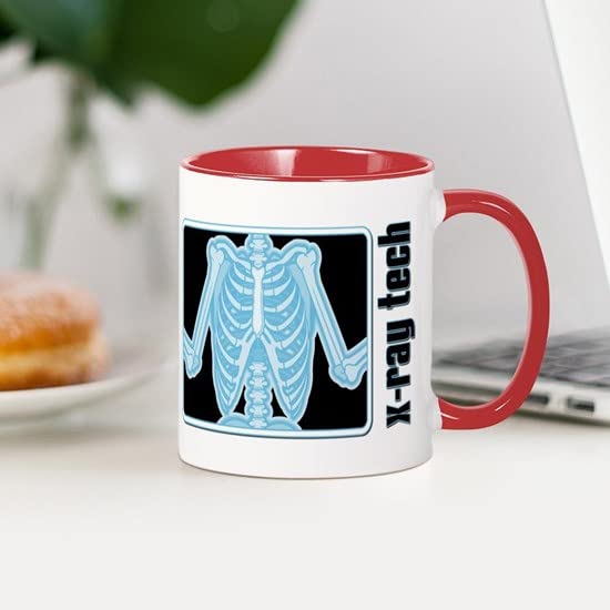 CafePress X Ray Tech Mug Ceramic Coffee Mug, Tea Cup 11 oz