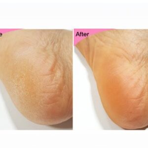 Essential Foot and Heel Peeling Mask Exfoliat Foot Peel - 2 Sheets