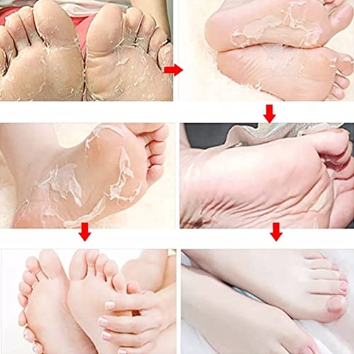 Foot Peel Mask (2 Pack) - Chracked Heel Repair, Dead Skin Remover for Baby Soft Feet - Natural Treatment