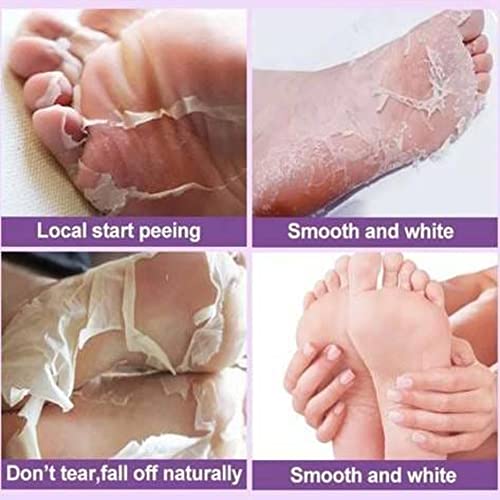 Foot Peel Mask (2 Pack) - Chracked Heel Repair, Dead Skin Remover for Baby Soft Feet - Natural Treatment