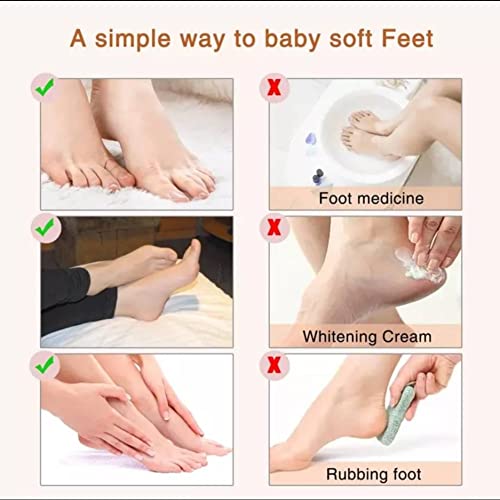 Foot Peel Mask (2 Pack) - Chracked Heel Repair, Dead Skin Remover for Baby Soft Feet - Natural Treatment