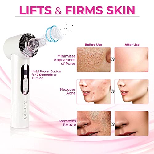 Bronich FDA Certified-Newest Blackhead Remover Pore Vacuum with 30X HD Camera,Deep Pore Cleaner and Blackhead Extractor with 5 Adjustable Suction Levels,USB Rechargeable for Women-Men Skin Care