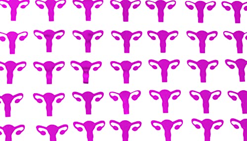 ROFLmart Uterus Party Bundle Banner Confetti And Balloon Decorations For Hysterectomy Party