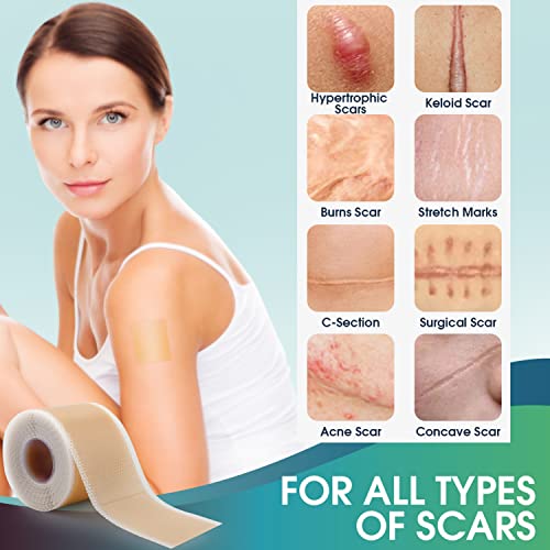 (1.6" x 150" Roll-3.8M) Professional Silicone Scar Sheets - Scars Removal Treatment - Reusable Silicone Scar Strips Type for Keloid, C-Section, Surgery, Burn, Acne et
