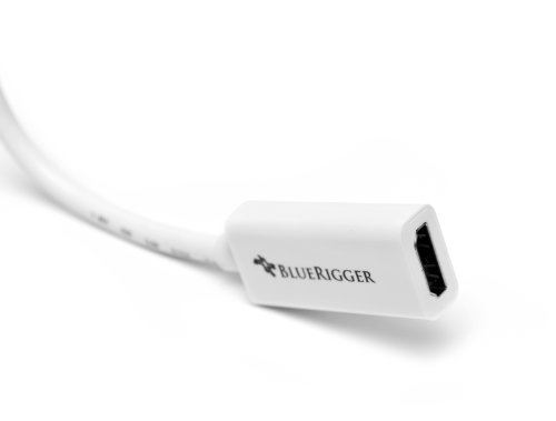 BlueRigger Mini DisplayPort to HDMI Female Adaptor Cable ((Mini DP/Thunderbolt to HDMI Cable) - Compatibe with MacBook Pro/Air - with HD Audio