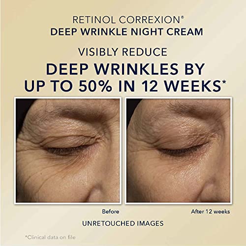 RoC Retinol Value Set Duo, Deep Wrinkle Anti-Aging Night Face Cream + Retinol Correxion Daily Eye Cream, Under Eye Cream for Dark Circles & Puffiness, Moisturizer for Deep Set Wrinkles