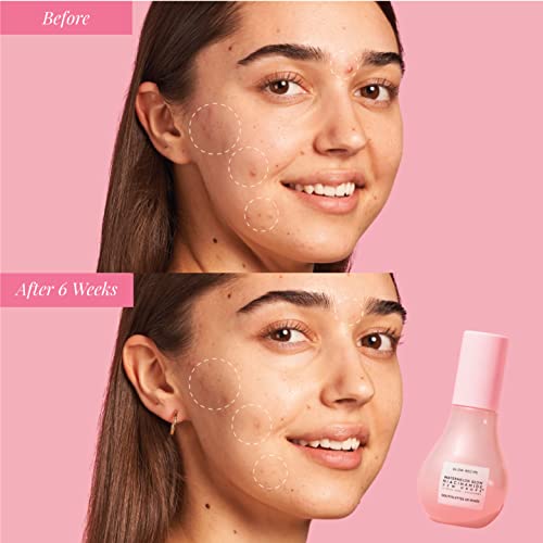 Glow Recipe Watermelon Glow Niacinamide Dew Drops Brightening Serum with Hyaluronic Acid & Moringa Oil + Vitamin E - Hydrating Lightweight Face Serum + Hyperpigmentation Treatment (40ml)