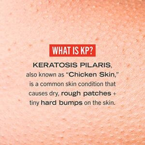 First Aid Beauty KP Bump Eraser Body Scrub Exfoliant for Keratosis Pilaris with 10% AHA – 8 oz