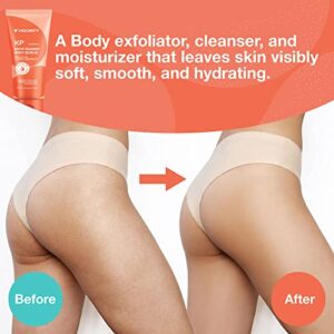 KP Bump Eraser Body Scrub, Body Exfoliating Scrub, Keratosis Pilaris Treatment, Strawberry Legs Treatment, Exfoliating Body Wash, Strawberry Skin Treatment, Scrubs for Women & Men Exfoliation - 8.45OZ