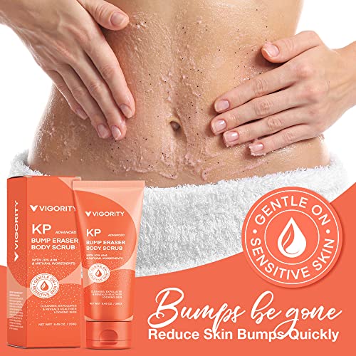 KP Bump Eraser Body Scrub, Body Exfoliating Scrub, Keratosis Pilaris Treatment, Strawberry Legs Treatment, Exfoliating Body Wash, Strawberry Skin Treatment, Scrubs for Women & Men Exfoliation - 8.45OZ