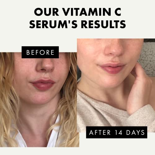 PURE Vitamin C Serum for Face 20% Vitamin C Facial Serums with Hyaluronic Acid Retinol Vit E Antioxidant Vitamin C Face Oil Skin Brightening Serum Anti Aging Reduce Wrinkles & Dark Spots