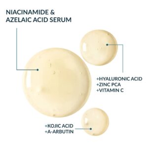 Niacinamide & Azelaic Acid Face Serum 12% - Natural Dark Spot Corrector & Hyperpigmentation Treatment, Brightening Serum, Manages Cystic Acne & Rosacea with Kojic Acid & A-Arbutin, 1 oz