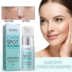 3Pack Musely Dark Spot Cream,Dark Spot remover for Face,The Spot Cream for Face,Dark Spot Correct Cream, Freckle Remover and Discoloration Correcting Serum