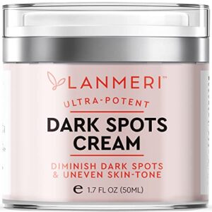 lanmeri dark spot remover for face and body, dark spot corrector fade cream, age spot, brown spot, sun spot & freckle remover for face, hands and other body areas, for both women and men, for all skin types
