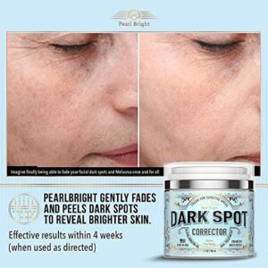 PearlBright Dark Spot Remover for Face, Body and Sensitive Areas - Natural Skincare for Underarms, Elbows & Privates - Made in USA - Dark Spot Corrector with Licorice, Mulberry Extract Arbutin, 1.7OZ