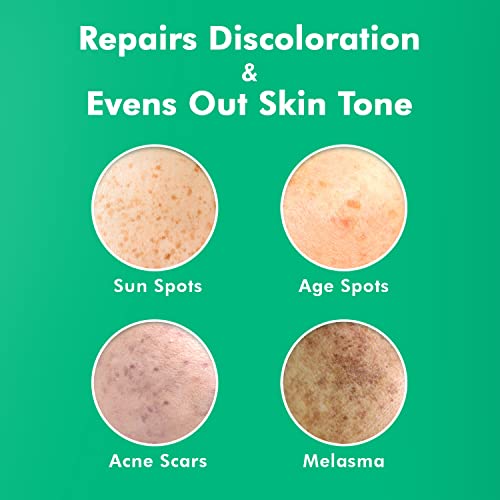Ebanel Dark Spot Remover for Face Peel Skin Brightening Cream Melasma Hyperpigmentation Treatment Sun Spot Age Spot Freckle Remover Fade Cream, Synovea, 4-Butylresorcinol, Niacinamide, Glutathione