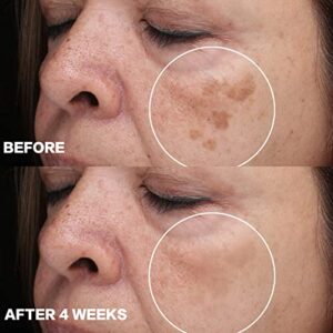 CITYGOO Dark Spot Remover for Face and Body, Dark Spot Corrector Cream, Natural Ingredient,Enriching Skin Care For All Skin Tones - Sun Spot, Melasma, Freckle Remover & Blemish Reducer-1 FL OZ
