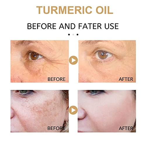 2022 New Turmeric Dark Spot Corrector Serum，Natural Turmeric Dark Spot Corrector Serum for Face， Skin Care Moisturizing Repair Serum(2PCS-60ml)