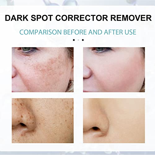 Dark Spot Remover Cream for Face, Dark Spot Cream, The Spot Cream for Face, Skin Spot Remover Cream, Dark Spot Correct Cream, Take Effect Quickly (5pcs) (3pcs)