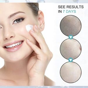 Dark Spot Remover Cream for Face, Dark Spot Cream, The Spot Cream for Face, Skin Spot Remover Cream, Dark Spot Correct Cream, Take Effect Quickly (5pcs) (3pcs)