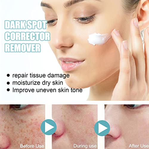 Dark Spot Remover Cream for Face, Dark Spot Cream, The Spot Cream for Face, Skin Spot Remover Cream, Dark Spot Correct Cream, Take Effect Quickly (5pcs) (3pcs)