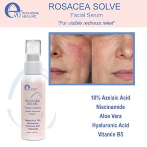 E70 Rosacea Solve Set - Includes Rosacea Cream, Serum and Moisturizing Face Wash - Combined Beneficial Ingredients such as Aloe Vera, Hyaluronic Acid, Niacinamide Coconut Oil, Cucumber, Wheat, Fruit Extracts, Licorice, Azelaic Acid 10% Chamomile Extracts