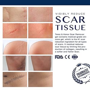 Scar Cream Gel, Advanced Silicone Scar Gel for Surgical Scars, C-Section, Stretch Marks, Acne, Surgery, Surgical Effective Treatment, Old and New Scars Management - 30g