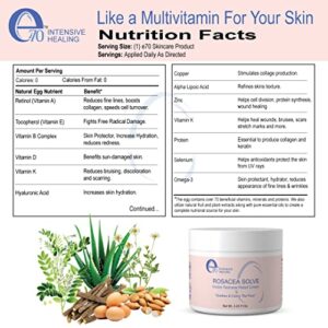 E70 Rosacea Solve - Redness Relief Cream - Calming Face Moisturizer For Rosacea and Acne-Prone Skin - Sensitive Skin Care With Organic Ingredients such as Aloe Vera, Almond Oil, Licorice and Chamomile Extracts - No Parabens