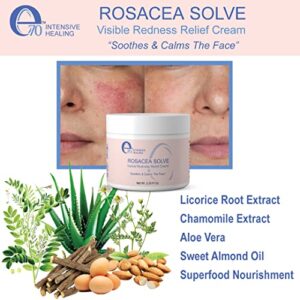 E70 Rosacea Solve - Redness Relief Cream - Calming Face Moisturizer For Rosacea and Acne-Prone Skin - Sensitive Skin Care With Organic Ingredients such as Aloe Vera, Almond Oil, Licorice and Chamomile Extracts - No Parabens