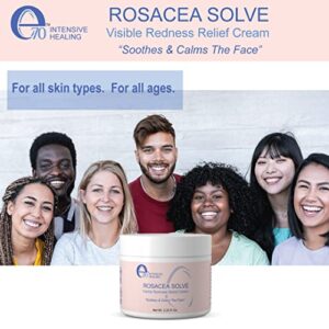 E70 Rosacea Solve - Redness Relief Cream - Calming Face Moisturizer For Rosacea and Acne-Prone Skin - Sensitive Skin Care With Organic Ingredients such as Aloe Vera, Almond Oil, Licorice and Chamomile Extracts - No Parabens