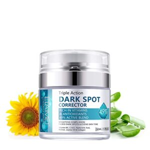 dark spot remover for face, dark spot corrector and remover, sun spots melasma freckle remover, packed with vitamins and natural extracts to treat dark spots, age spots, or sunspots (a)