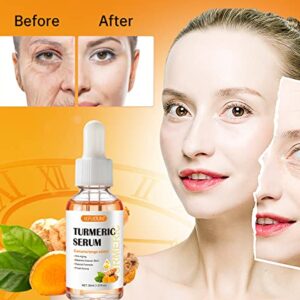 Turmeric Serum for Dark Spots Remover, Turmeric Dark Spot Corrector Serum for Face & Body, Anti Aging Facial Serum for Women and Men, Skin Care Moisturizing Repair Serum, Improve Skin Tone (1Fl Oz)