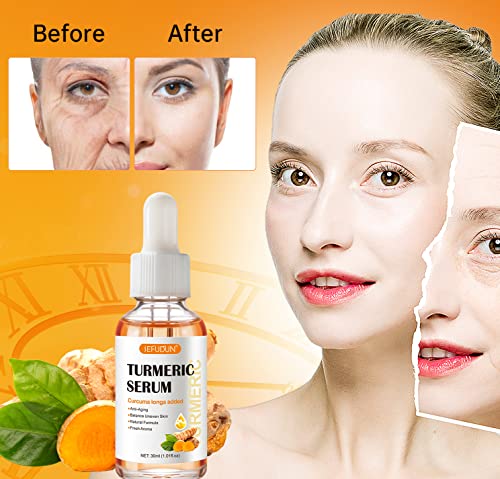 Turmeric Serum for Dark Spots Remover, Turmeric Dark Spot Corrector Serum for Face & Body, Anti Aging Facial Serum for Women and Men, Skin Care Moisturizing Repair Serum, Improve Skin Tone (1Fl Oz)