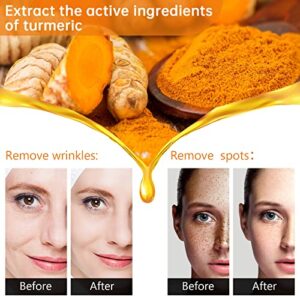 Turmeric Serum for Dark Spots Remover, Turmeric Dark Spot Corrector Serum for Face & Body, Anti Aging Facial Serum for Women and Men, Skin Care Moisturizing Repair Serum, Improve Skin Tone (1Fl Oz)