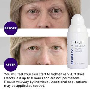 Beverly Hills V-Lift Instant Eye Lift and Eye Tuck Bee Venom Serum for Puffy Eyes, Dark Circles, Wrinkles, and Under Eye Bags Treatment for Women and Men | 30mL (120 Day Supply)