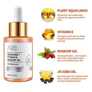 ANAI RUI Squalane + Vitamin E Rosehip Oil Moisturizer for Face Hydrate, Reduce Scars and Stretch Marks, Wrinkles for Smoother, Softer Skin 1 fl. Oz